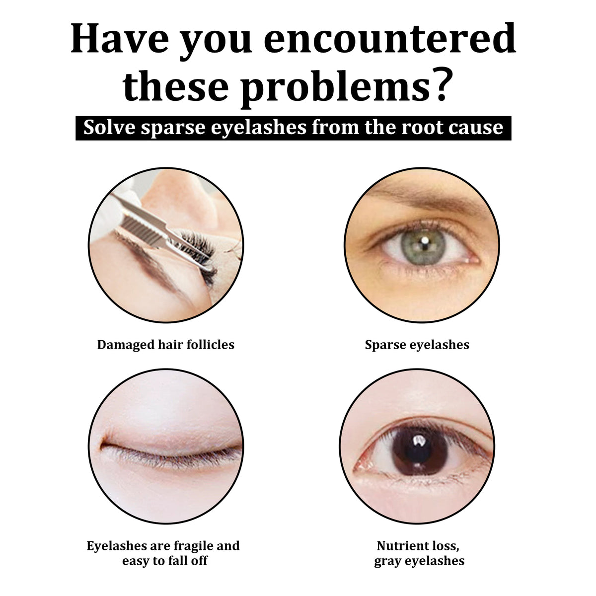 Four circular images illustrating eyelash issues: damaged follicles, sparse lashes, fragile lashes, and nutrient loss.