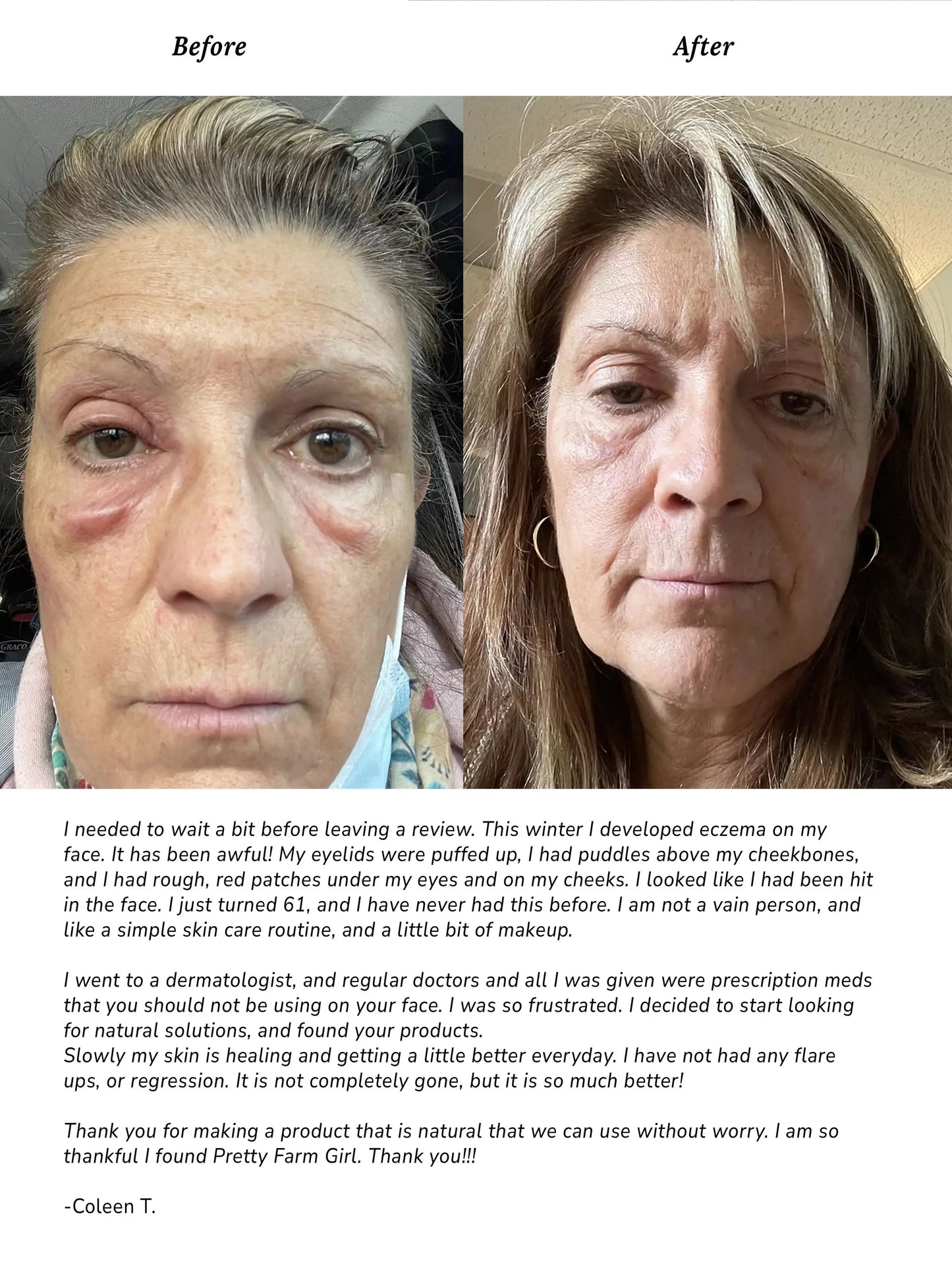 Pure + Simple Skin Kit for Sensitive Skin - Plush Fashion Hub